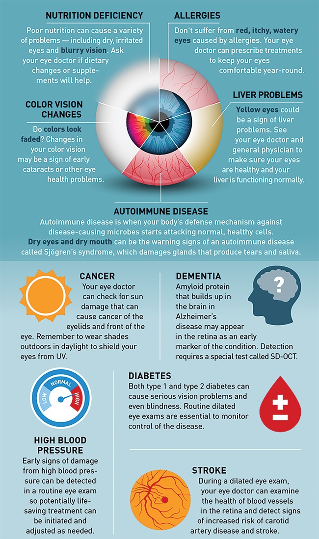 New Infographic 10 Eye Health Problems Detected Through Our Eyes 